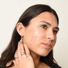 Why Your Skincare Routine Might Be Causing Breakouts