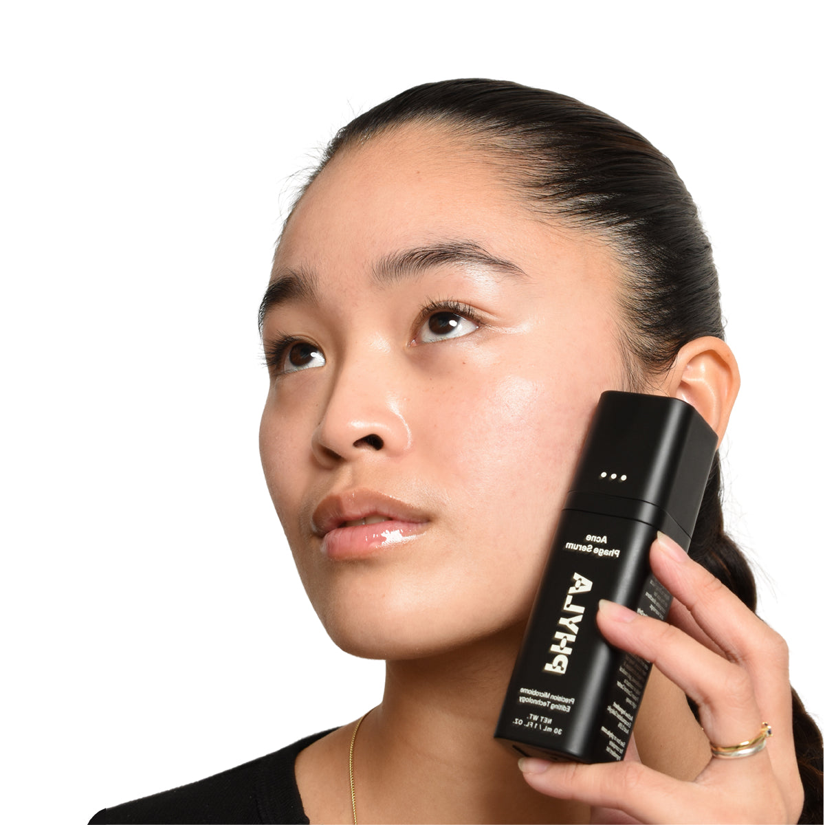 Acne Explained: Types, Causes, and How It’s Treated