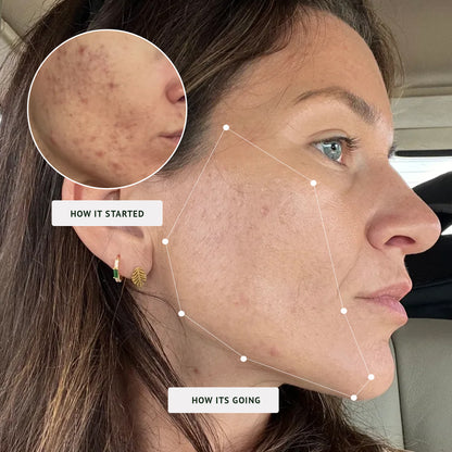 Phluff Moisturizer