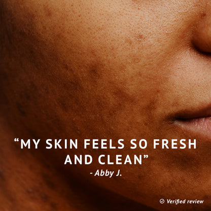 Phresh Gel Cleanser