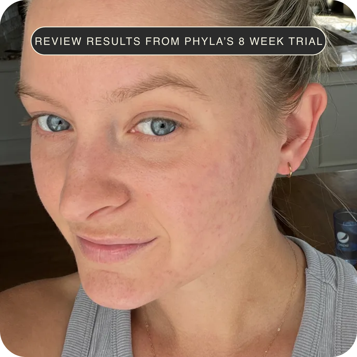 Learn about Phyla results.